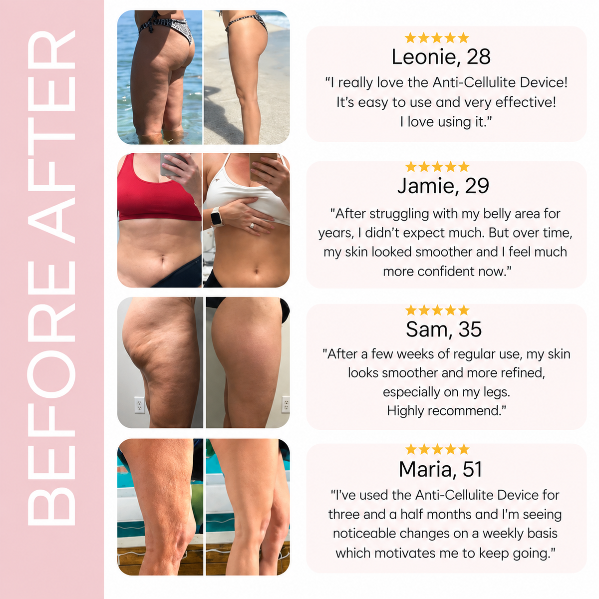 Anti-Cellulite Therapy Device for Skin Tightening & Wrinkle Reduction