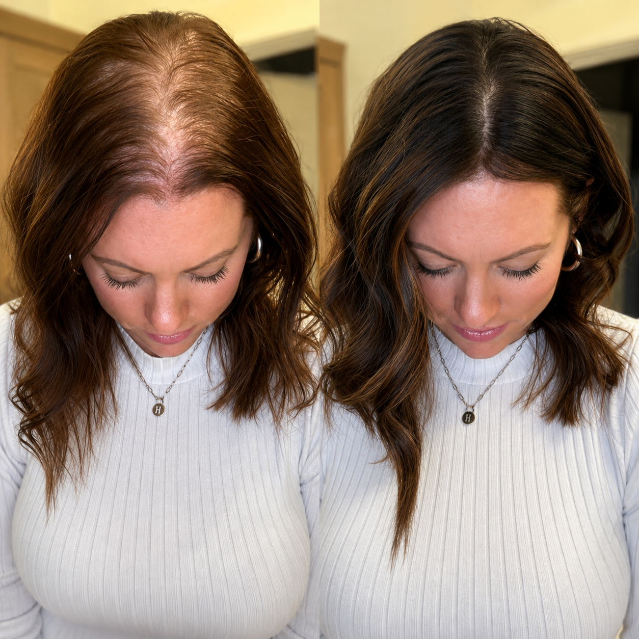Advanced Hair Growth Roll-on Serum