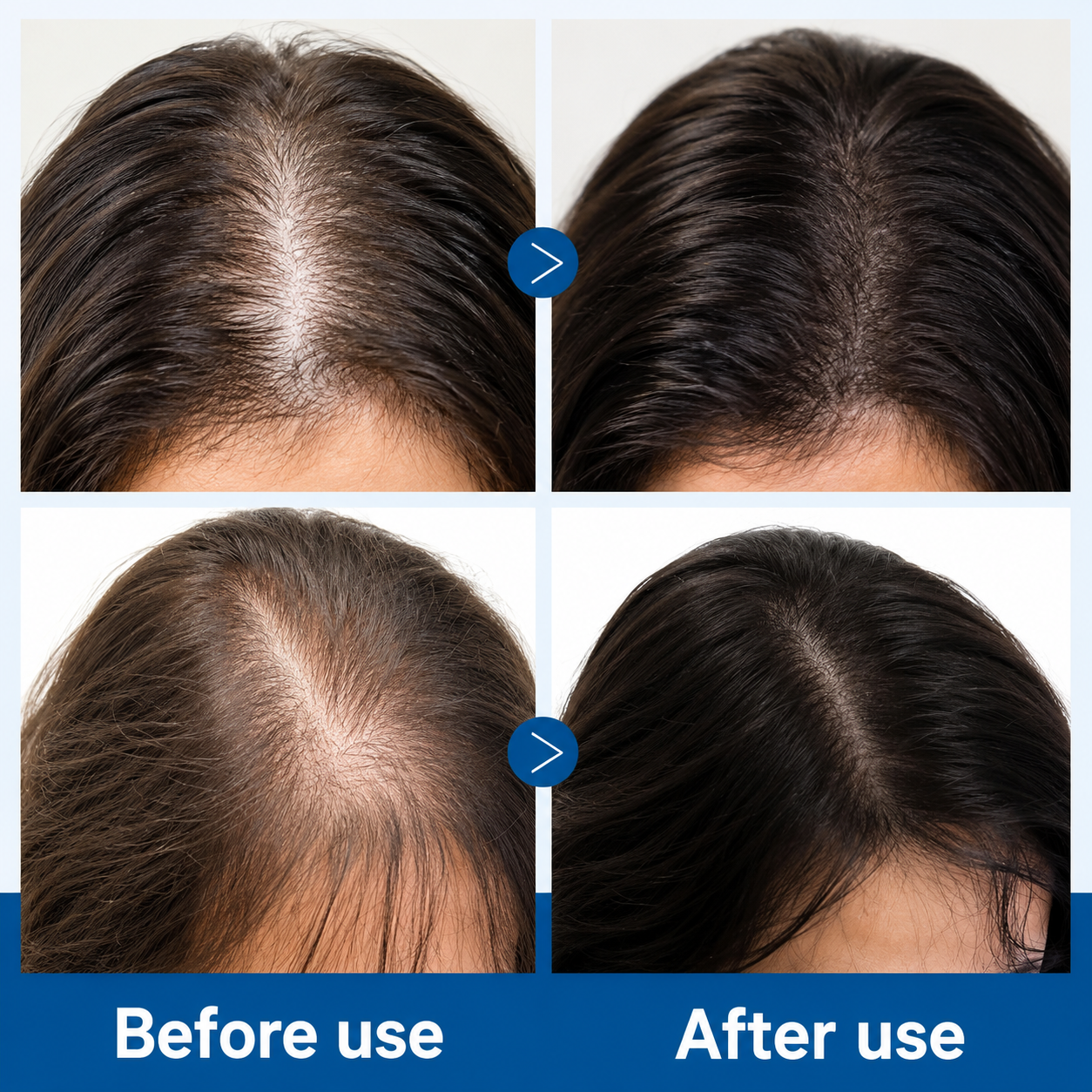 Advanced Hair Growth Roll-on Serum